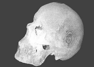 Первая пластиковая модель черепа человека