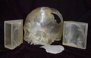 Модель черепа, заплатки и формы для отливки импланта