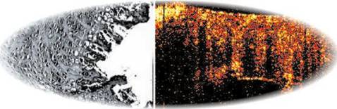 Рост гиалинового хряща в зоне лазерного воздействия; микрофотография, x150